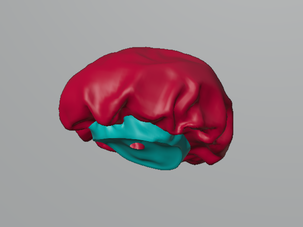 Bonnet